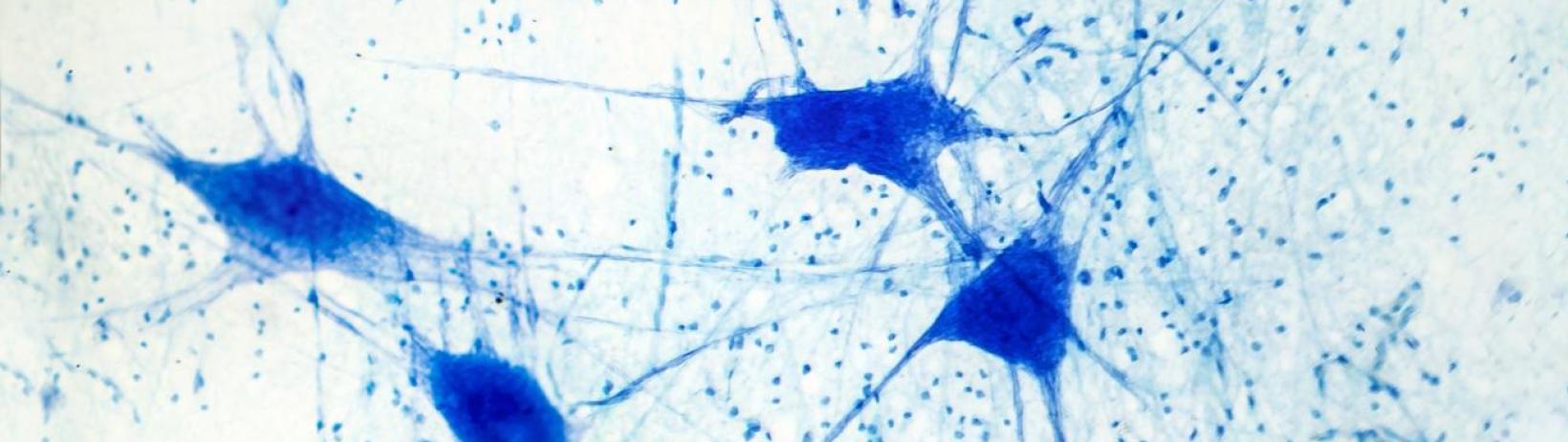 Dendrite - Source : Shutterstock